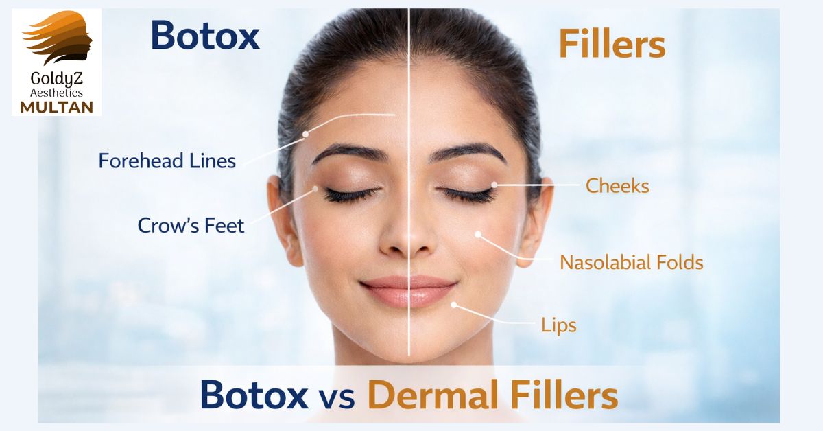 Botox Vs. Dermal Fillers - GoldyZ Multan Aesthetics