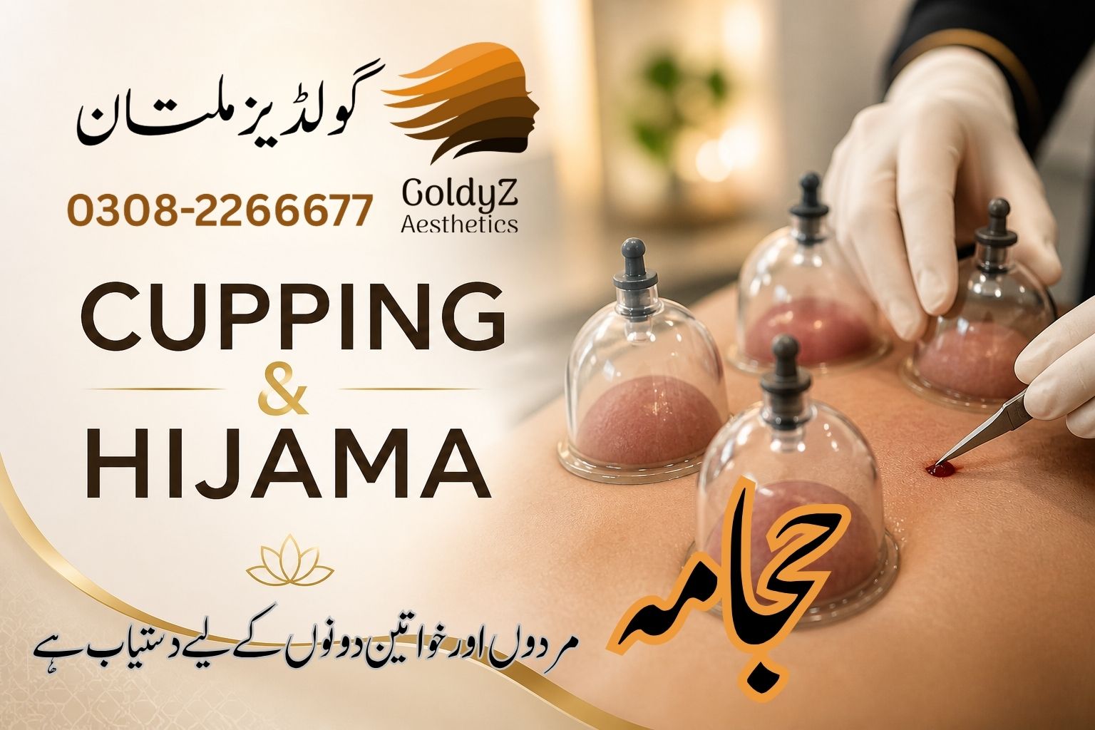 Hijama in Multan For For Both Male and Female Available at GoldyZ