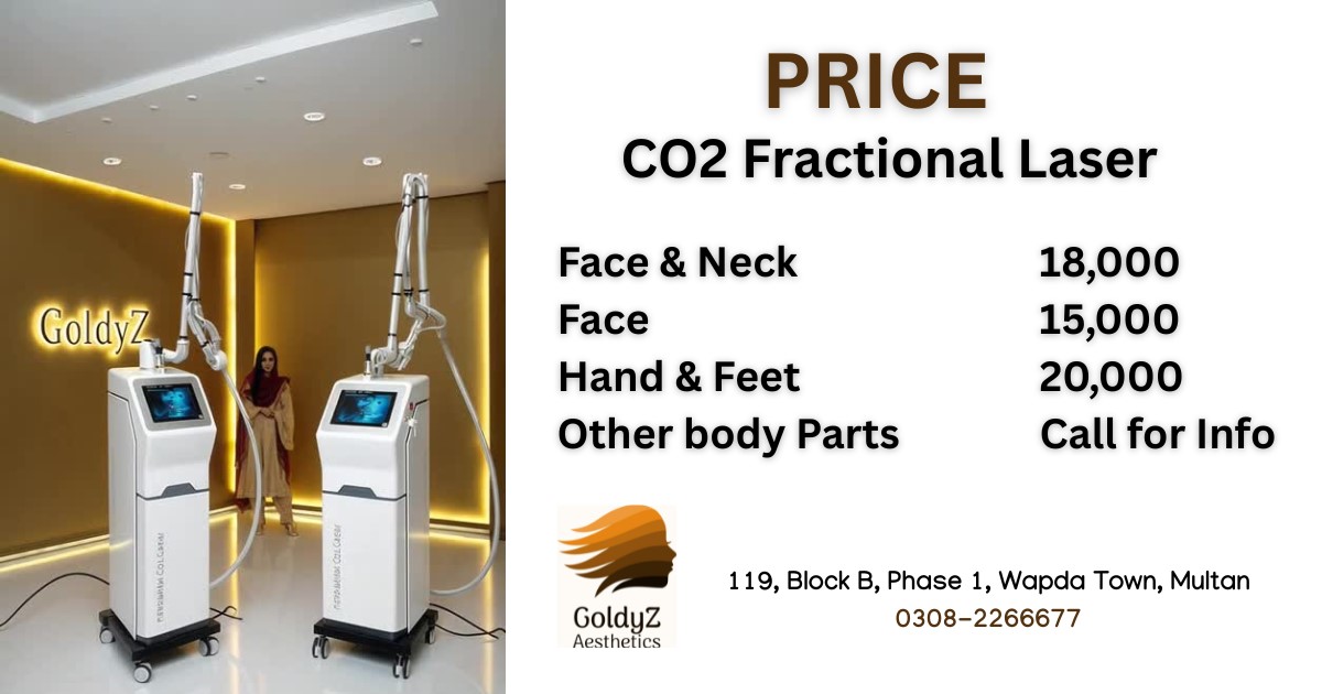 CO2 laser price in Multan GoldyZ